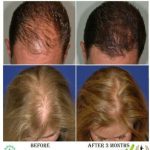 BRAZILIAN KERATIN MOISTURIZING HAIR PROTEIN SERUM 100ML - Image 2