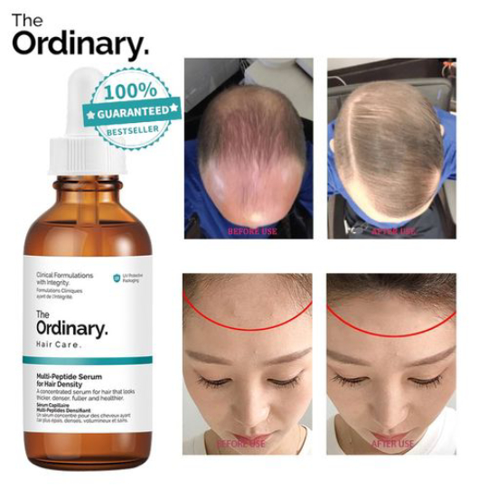 The Ordinary Hair Serum For Growth The Ordinary Hair Serum For Growth
